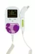 Fetal Doppler Spengler